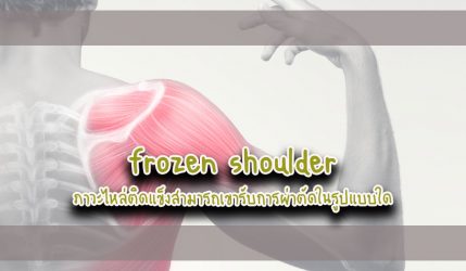 frozen shoulder ภาวะไหล่ติดแข็งสามารถเขารับการผ่าตัดในรูปแบบใด